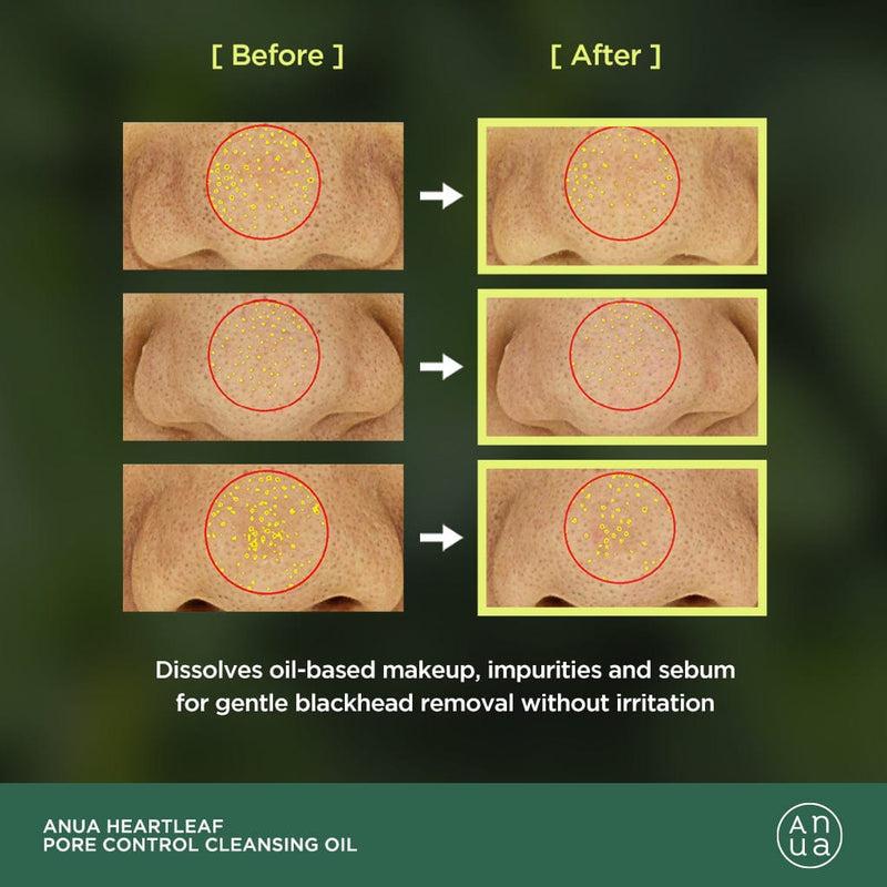 [Anua] HEARTLEAF PORE CONTROL CLEANSING OIL 200ml gjwi4x-qp
