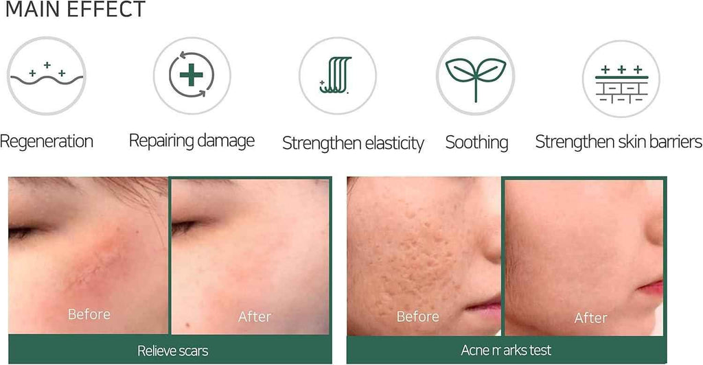 Some By Mi AHA-BHA-PHA 30 Days Miracle Cream 60g