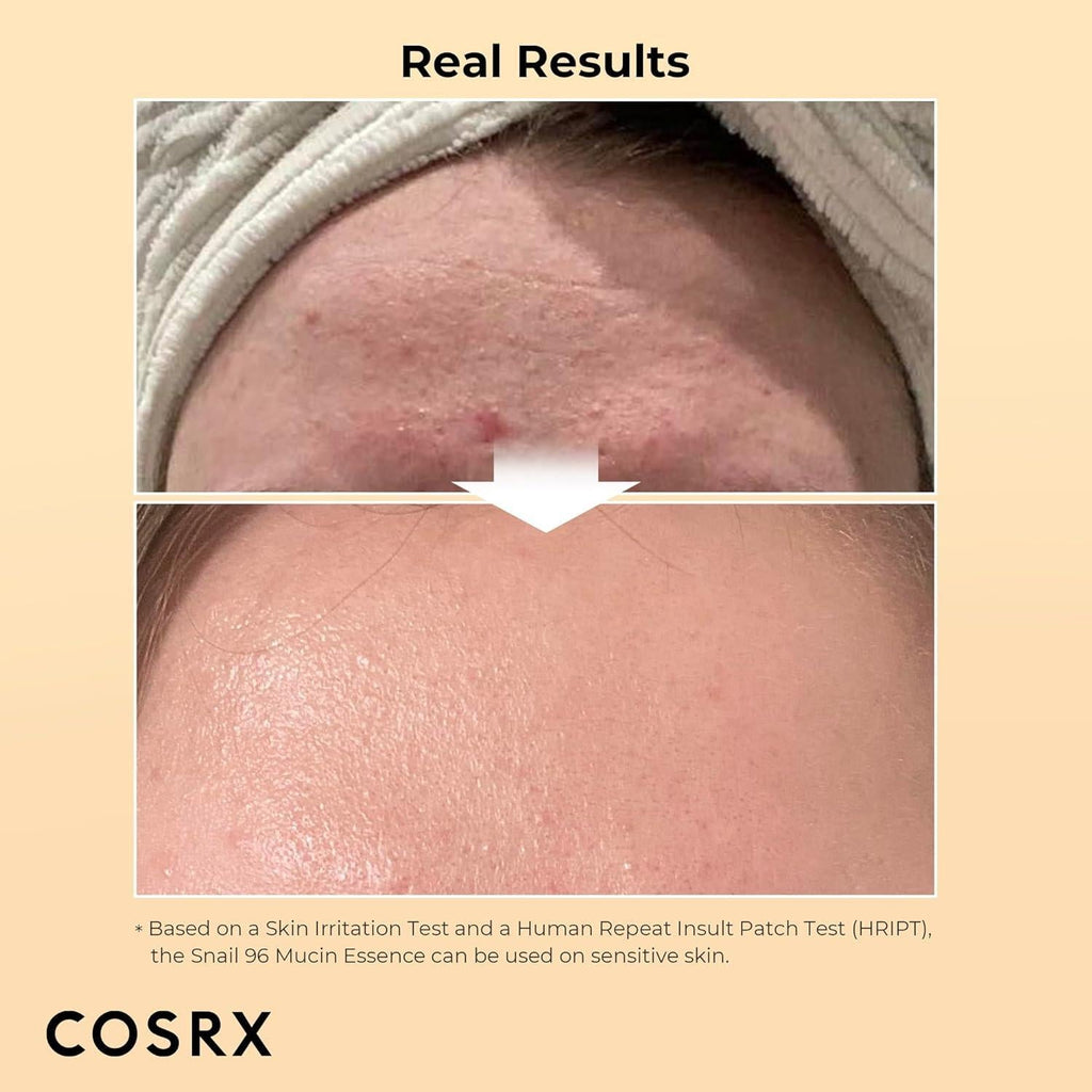[Cosrx] Advanced Snail 96 Mucin Power Essence 100ml Gotta Glow