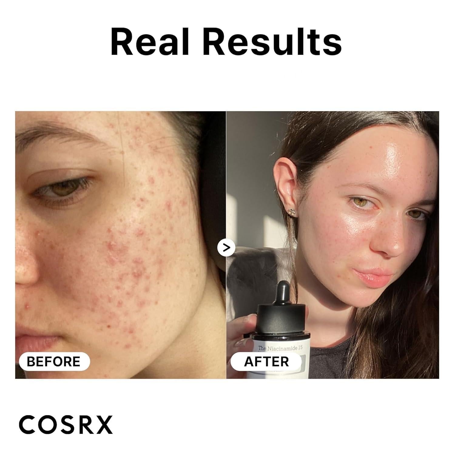 [Cosrx] The Niacinamide 15 Serum 20ml Gotta Glow