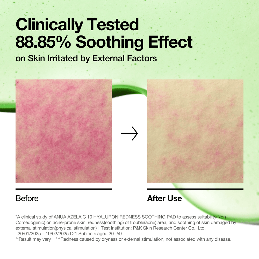 [Anua] Azelaic 10 Hyaluron Redness Soothing Pad 230ml 90ea Gotta Glow