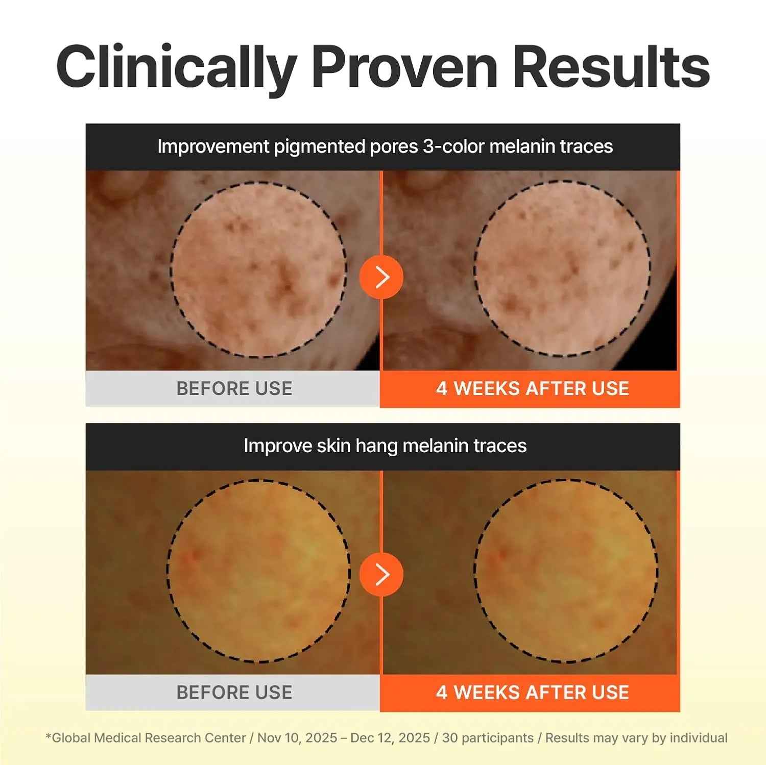 [Centellian24] Madeca Vitamin 15+ Glowing Serum 30ml