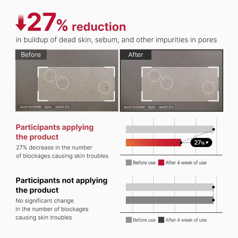 Medicube Red Acne Body Peeling Shot 110ml