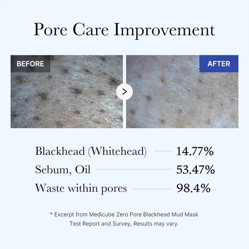 Medicube Zero Pore Blackhead Mud Mask 100ml